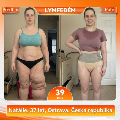 ✅Oficiální značková prodejna |🛡️ 𝐏𝐀𝐔𝐑𝐀𝐉𝐔® 𝟐𝟎𝟐𝟔 𝟒𝐕𝟏 𝐌𝐈𝐑𝐎ČÁ𝐒𝐓𝐈𝐂𝐎𝐕É 𝐓𝐕𝐀𝐑𝐀𝐉Í𝐂Í 𝐀 𝐓𝐔𝐊 𝐒𝐏𝐀𝐋𝐔𝐉Í𝐂Í 𝐊𝐑Á𝐓𝐊É 𝐊𝐀𝐋𝐇𝐎𝐓𝐘👩‍⚕️