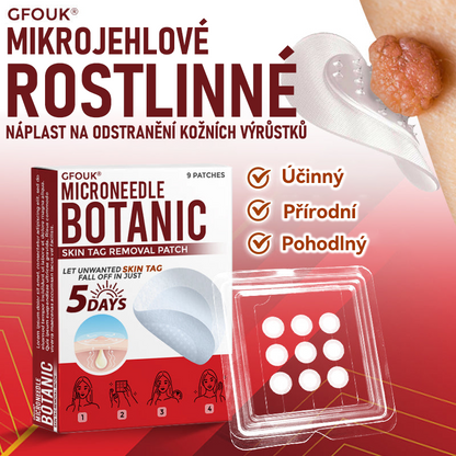 🎁 🎁 Zbývá už jen 5 balení! Nyní můžete získat dodatečnou SLEVU 50 %! Pomáhá viditelně zmenšit fibromy, bradavice a další nedokonalosti pokožky — rychle, pohodlně a bez bolesti. 🌿