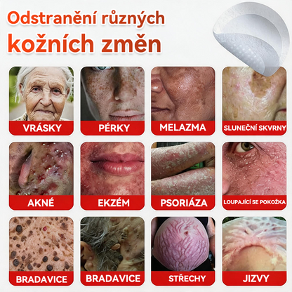 🎁 🎁 Zbývá už jen 5 balení! Nyní můžete získat dodatečnou SLEVU 50 %! Pomáhá viditelně zmenšit fibromy, bradavice a další nedokonalosti pokožky — rychle, pohodlně a bez bolesti. 🌿