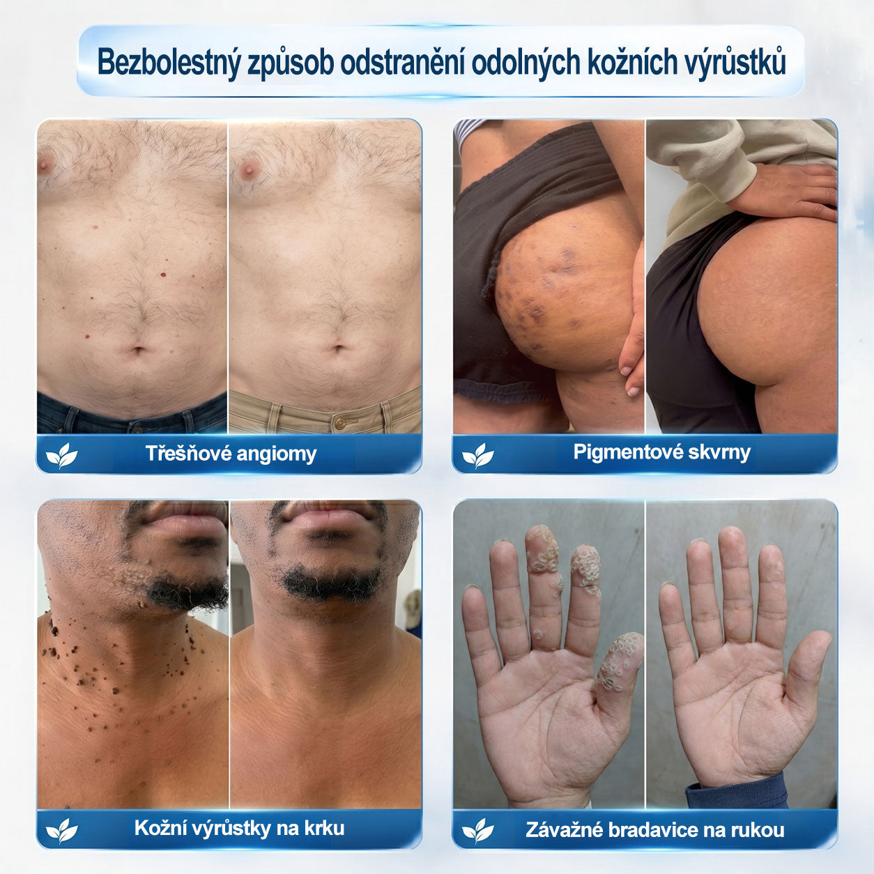 Oficiální značkový obchod |👩‍⚕️𝐏𝐢𝐜𝑑𝑜® 𝟩𝖽𝖾𝗻𝗻í 𝘰𝘥𝘴𝘵𝗋𝖺ň𝗈𝗏𝖺č 𝒔𝒌𝒗𝒓𝙣 𝙖 𝙥𝙞𝙜𝙢𝙚𝙣𝙩𝘰𝘷ý𝘤𝘩 𝘴𝘬𝖛𝖗𝖓 (Bezbolestný rollerball bez jizev)🎉