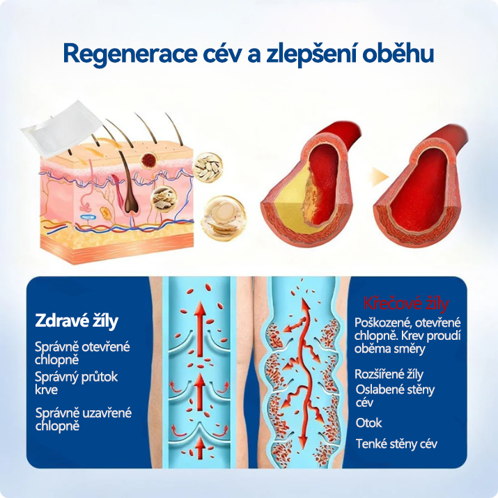 🎁 Zbývá už jen 5 balení! Nyní můžete získat dodatečnou SLEVU 50 %! 🏆🇨🇿👨‍⚕️✅TAILEDEN® VeinEase Mikronáplast s mikrojehličkami⚡Okamžitá úleva, dlouhodobé výsledky